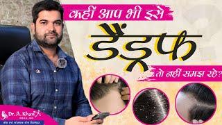 कहीं आप भी इसे Dandruff तो नही समझ रहे | Dandruff Treatment At Home | Dr. A Khan Allahabad