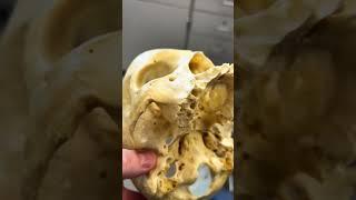 REAL Human Skull