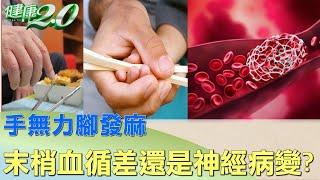 手無力腳發麻 是末梢血循差還是神經病變? 健康2.0