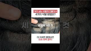 머리 심는 비절개 모발이식 삭발 방법 4가지