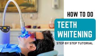 How to do Teeth Whitening