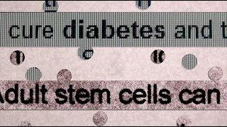 Diabetes and Stem Cells