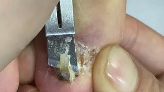 Why This Toenail Trimming is So Satisfying