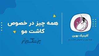 راز موها پر پشت؛ هر آنچه باید درباره کاشت مو بدانید.