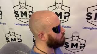 Scalp Micropigmentation - Central KY