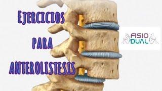 Ejercicios para ANTEROLISTESIS