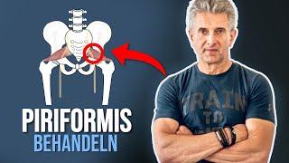 Stoppt endlich den Piriformis Wahnsinn | Teil 2