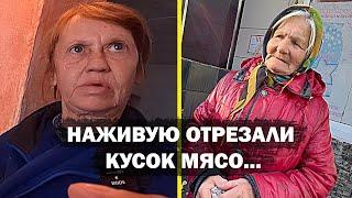 ЧТО МОГЛИ ВЫРЕЗАТЬ БЕЗ АНАСТЕЗИИ??? Помощь людям.