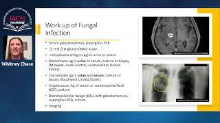 Inpatient Management of Acute Leukemia Undergoing High-Dose Chemotherapy