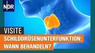 Schilddrüsenunterfunktion: Wann behandeln? | Visite | NDR