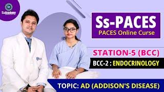 PACES 2023 New Format | ( AD )ADDISON'S DISEASE -Station- 5 |( BCC - 02 )| Endocrinology |@SsAcademy