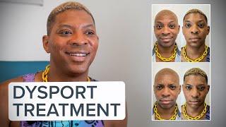 Dysport (Wrinkle Relaxer) - Patient Testimonial | West End Plastic Surgery