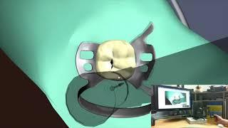 Dental Simulator - Dental Caries