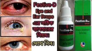 Festive-Dee এর ব্যবহার মাত্রা এবং পার্শ্ব প্রতিক্রিয়া সম্পূর্ন বাংলায়।#Rajbangshi medical.