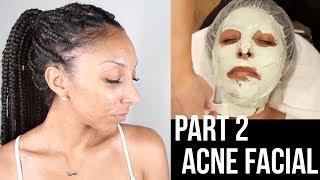 PART 2: Acne Facial w/ Mary Scott Skincare! | BiancaReneeToday