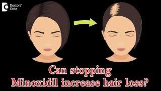 Latest solution for hair loss - Dr. Urmila Nischal