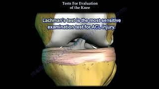 Tests For  Examination  Of The Knee   Everything You Need To Know   Dr  Nabil Ebraheim