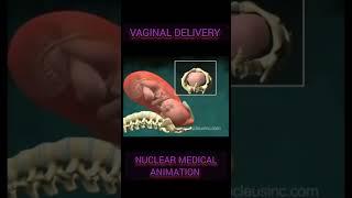 Vaginal Delivery (Birth) Animation Nuclear Medical #digestivesystem #surgerysimplified #birth