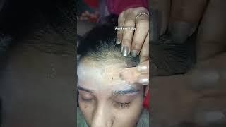 forhead beans wax#youtube #shortsvideo#trending  #shorts