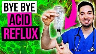 Acid reflux treatment for symptoms and home remedy diet