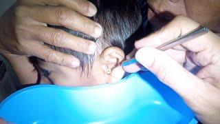 How to Remove Something Trapped & Stuck from Boys' Ear