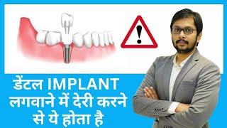 Dont get Late for  DENTAL IMPLANTS..WHY ??