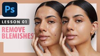 Remove Blemishes - Photoshop Retouching Course | Lesson 1