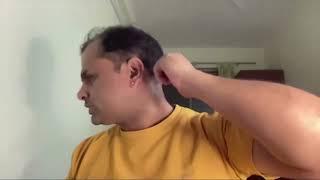 Diploma In Acupressure by Dr Hemant Sharma 19 Jan 2025