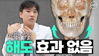 사각턱수술 해도 효과 없는 사람 있습니다 | 에이비성형외과