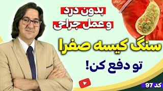 پیشگیری و درمان مجرب سنگ کیسه صفرا و کبد چرب در 3 هفته بدون درد و جراحی | دکتر جاوید