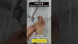 कृत्रिम हाथ l Artificial Silicone Hand #prosthetic #amputee #prosthetics #prosthetichand#viralvideo