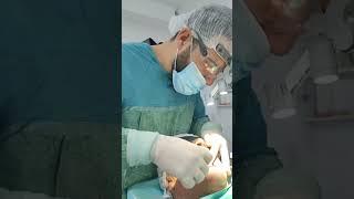 Dental implantasiya #implant #stomatoloq #tiktok #zirkonium #mrbeast