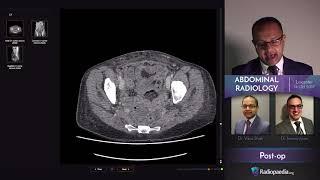 Abdominal Emergency Radiology Course - Trailer