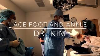 Excision of Os Navicularis (ACE Foot and Ankle Medical Clinic)