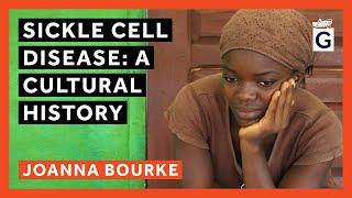 Sickle Cell Disease: A Cultural History