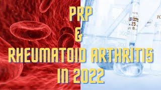 Can PRP Treat Rheumatoid Arthritis ? Inside Scoop and New Research From 2022