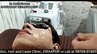 LASER HAIR REMOVAL IN ZIRAKPUR- 98769-31601