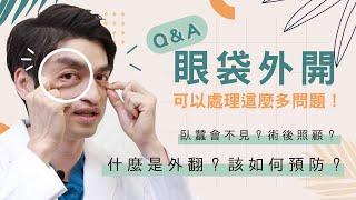 眼袋外開怕外翻？！三招預防！誰適合外開手術？容易傷到神經？網友各種疑問李子朋醫師精闢解析！