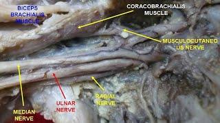 Brachial plexus