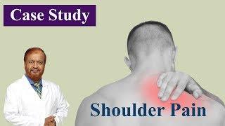 ঘাড় ব্যথার চিকিৎসা | Shoulder Pain Relief | Professor Dr Altaf Sarker