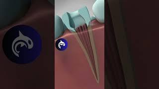 Root Canal