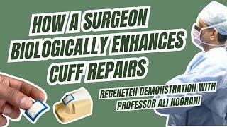 What Is Regeneten and Surgical Technique Demonstration with Professor Ali Noorani | Rotator Cuff