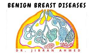 BENIGN BREAST DISEASE