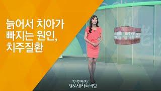 늙어서 치아가 빠지는 원인, 치주질환 - (20120714_421회 방송)_노년의 건강을 위협한다. 잇몸병, 치주질환