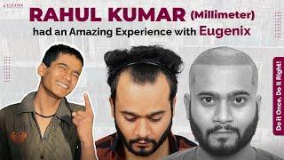 3 Idiots fame Film Actor Rahul Kumar's Hair Loss at 29 years and Hair Transplant Journey at Eugenix