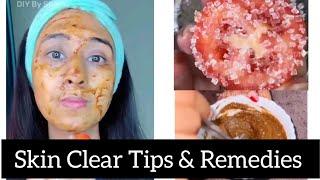 skin whitening tips// home remedies for Skin Care Tips #styleofyourlife