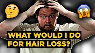 How Would I Prevent HAIR LOSS Now... Without the Use of 5-AR Inhibitors? 