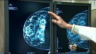 Torrance Memorial Medical Center To Offer 3D Mammograms