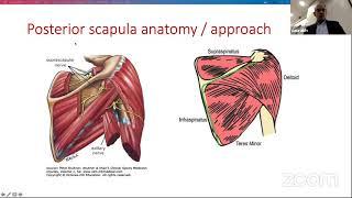 Orthopaedic Principles, London Upper Limb FRCS Course