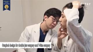 [ID Hospital Review] My double jaw experience in South Korea at ID Hospital!